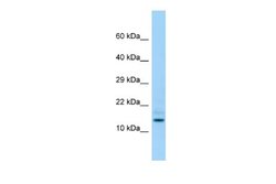 HDDC3 Antibody, Novus Biologicals 100 &mu;L | Buy Online | Novus Biologicals | Fisher Scientific